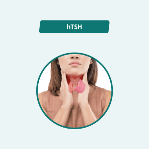 Thyroid-Stimulating Hormone (TSH)