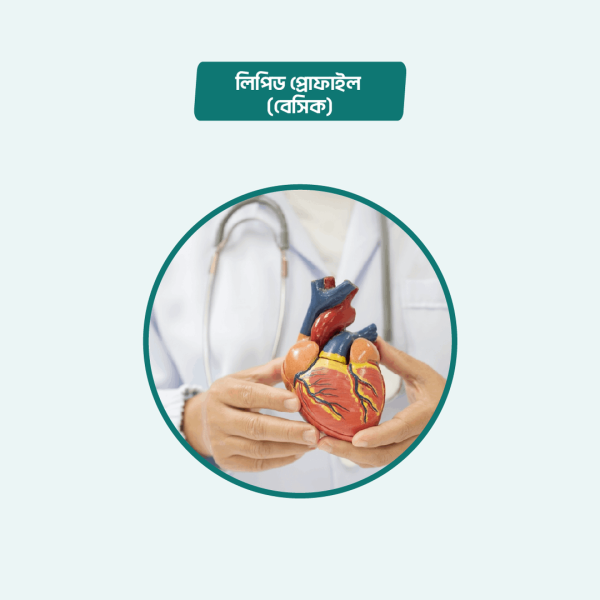 Lipid Profile (Fasting/Regular)