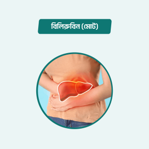 Bilirubin (Total)