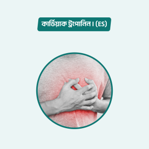 Cardiac Troponin-I (ES)