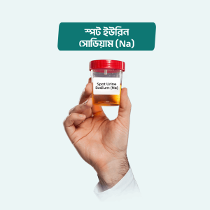 Spot Urine Sodium (Na)