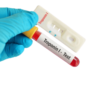 Troponin - I