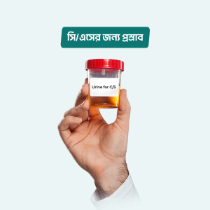 Urine for C/S